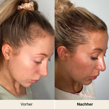 HairVital+