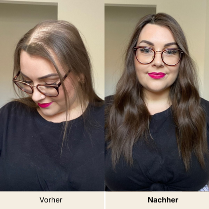 HairVital+