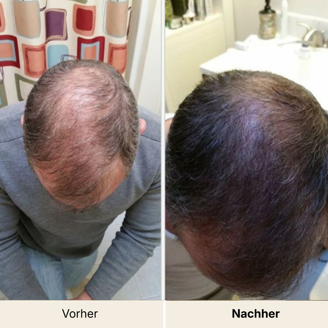 HairVital+